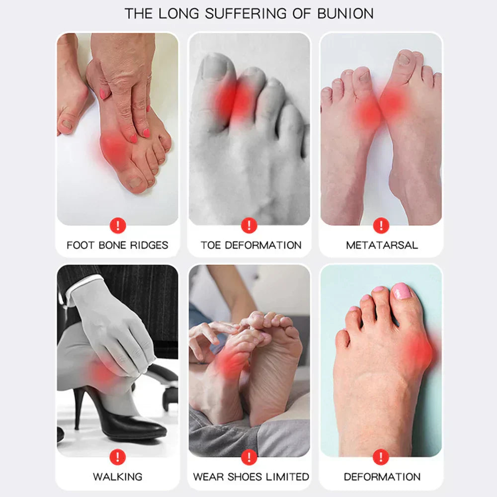 Hallux Valgus Foot Brace with Adjustable Side and Heel Straps