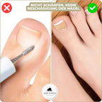 Nail Correction Strips for Ingrown and Deformed Nails, 10 Count, view 5