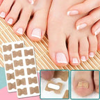 Nail Correction Strips for Ingrown and Deformed Nails, 10 Count