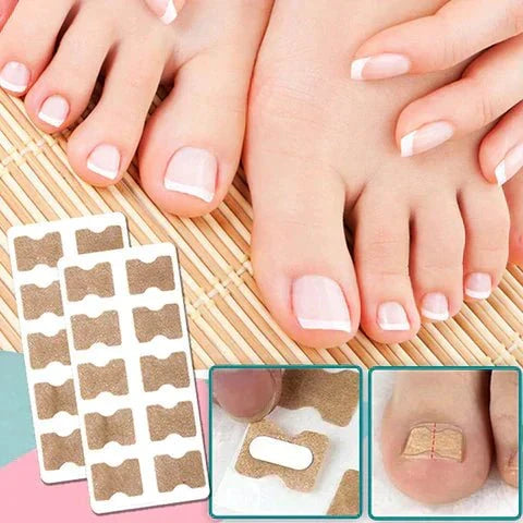Nail Correction Strips for Ingrown and Deformed Nails, 10 Count