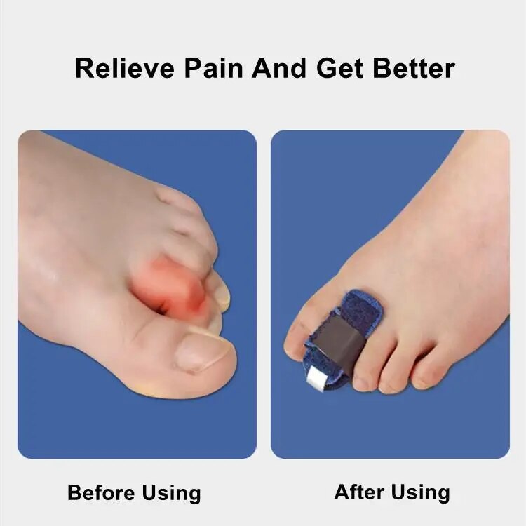 Toe Corrector Stabilizer Splint with Bendable Aluminum Bar, S/M, view 6